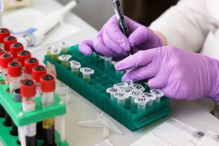 成都司法亲子鉴定多少钱？你该了解的亲子鉴定费用