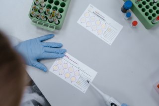 亲子鉴定出生证明挂哪个科室？成都哪个医院可以做DNA亲子鉴定？