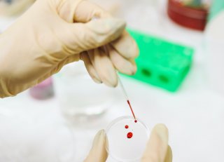 为什么输血后影响亲子鉴定？