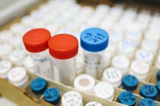 宜宾DNA亲子鉴定医院可以做吗和鉴定机构有什么区别