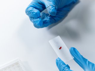 亲子鉴定的类型有哪些？遂宁有地方做亲子鉴定吗？