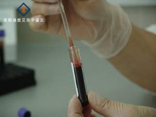 成都作亲子鉴定要多少钱